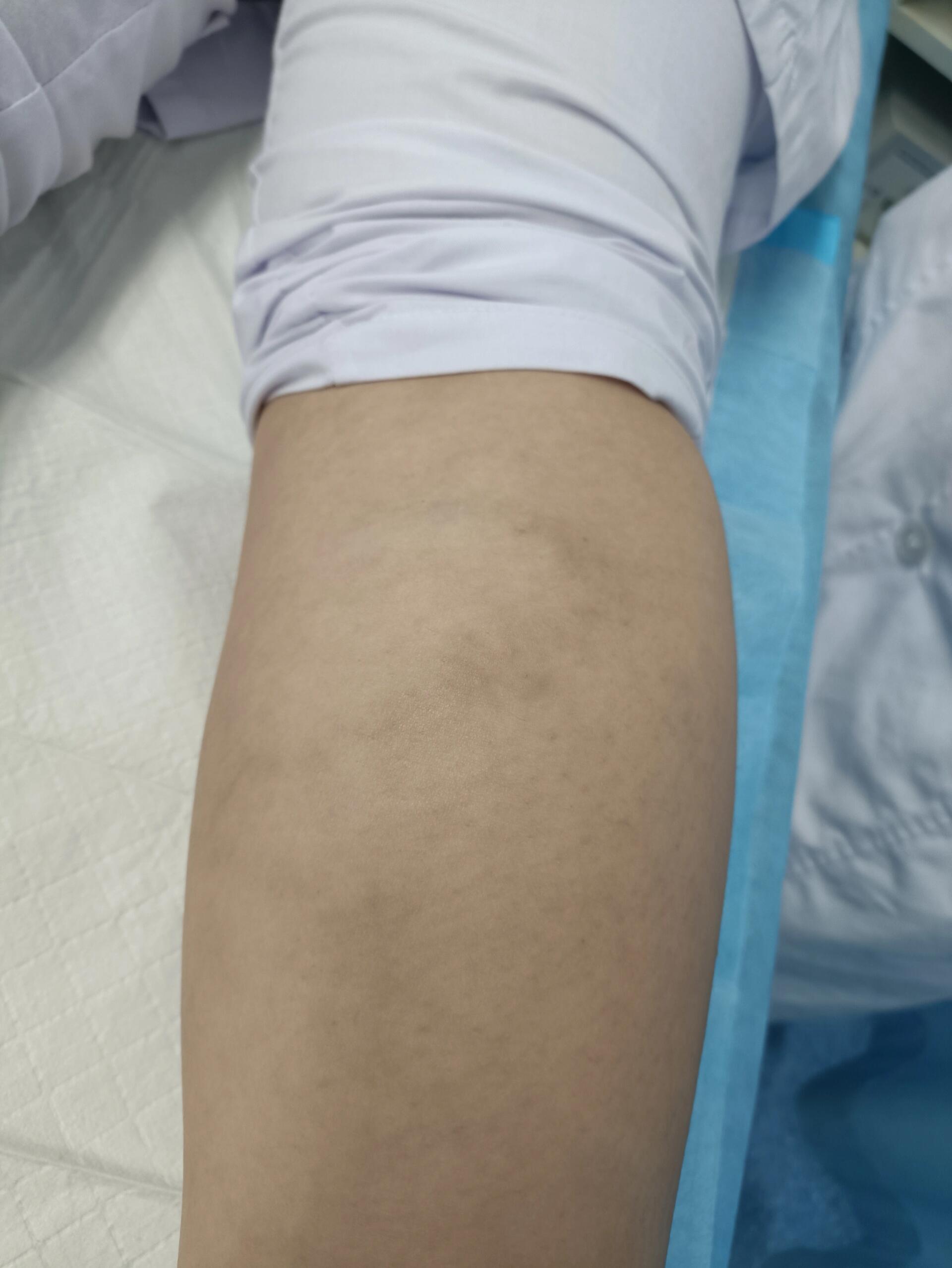 小腿伤病情况跟第六场时差不多不在乎外界是否尊重我们